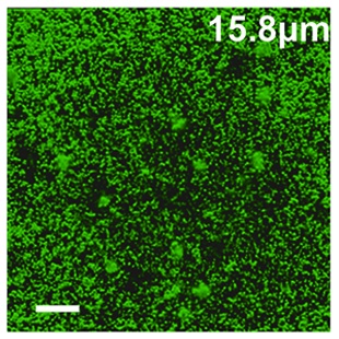 Pseudomonas aeruginosa grown in the space shuttle. From Kim W, Tengra FK, Young Z, Shong J, Marchand N, et al. (2013) Spaceflight Promotes Biofilm Formation by Pseudomonas aeruginosa. PLoS ONE 8(4): e62437. doi:10.1371/journal.pone.0062437 http://www.plosone.org/article/info%3Adoi%2F10.1371%2Fjournal.pone.0062437
