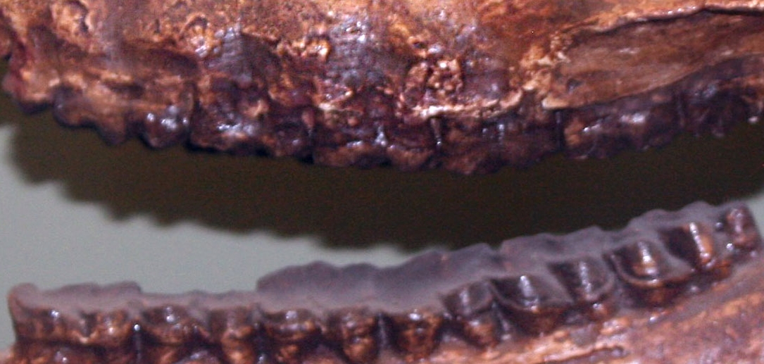 Whose teeth are these?